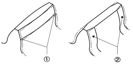 齒端修緣（修薄）
