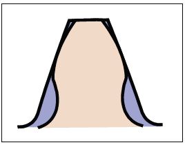 圖 4.3 　z10 × z200 的齒形比較